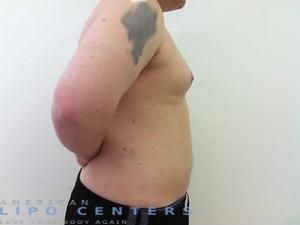 americanlipocenters_14.jpg